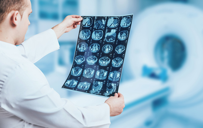 Un médecin examinant manuellement les résultats de l'imagerie médicale (Photo Adobe Stock) Un médecin examinant manuellement les résultats de l'imagerie médicale (Photo Adobe Stock)