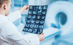 L’intelligence artificielle, une arme de plus dans le traitement contre le cancer ? L’intelligence artificielle, une arme de plus dans le traitement contre le cancer ?